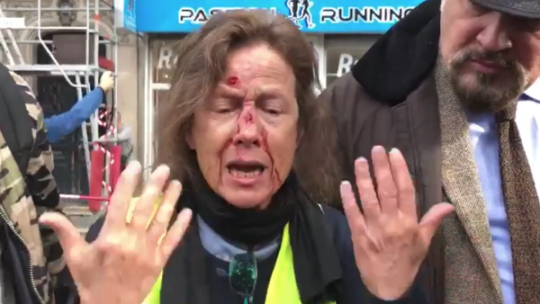 Marche De La Colère Des Policiers Une Gilet Jaune Blessée