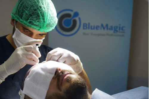 Best Hair Transplant Clinics in Istanbul 2022