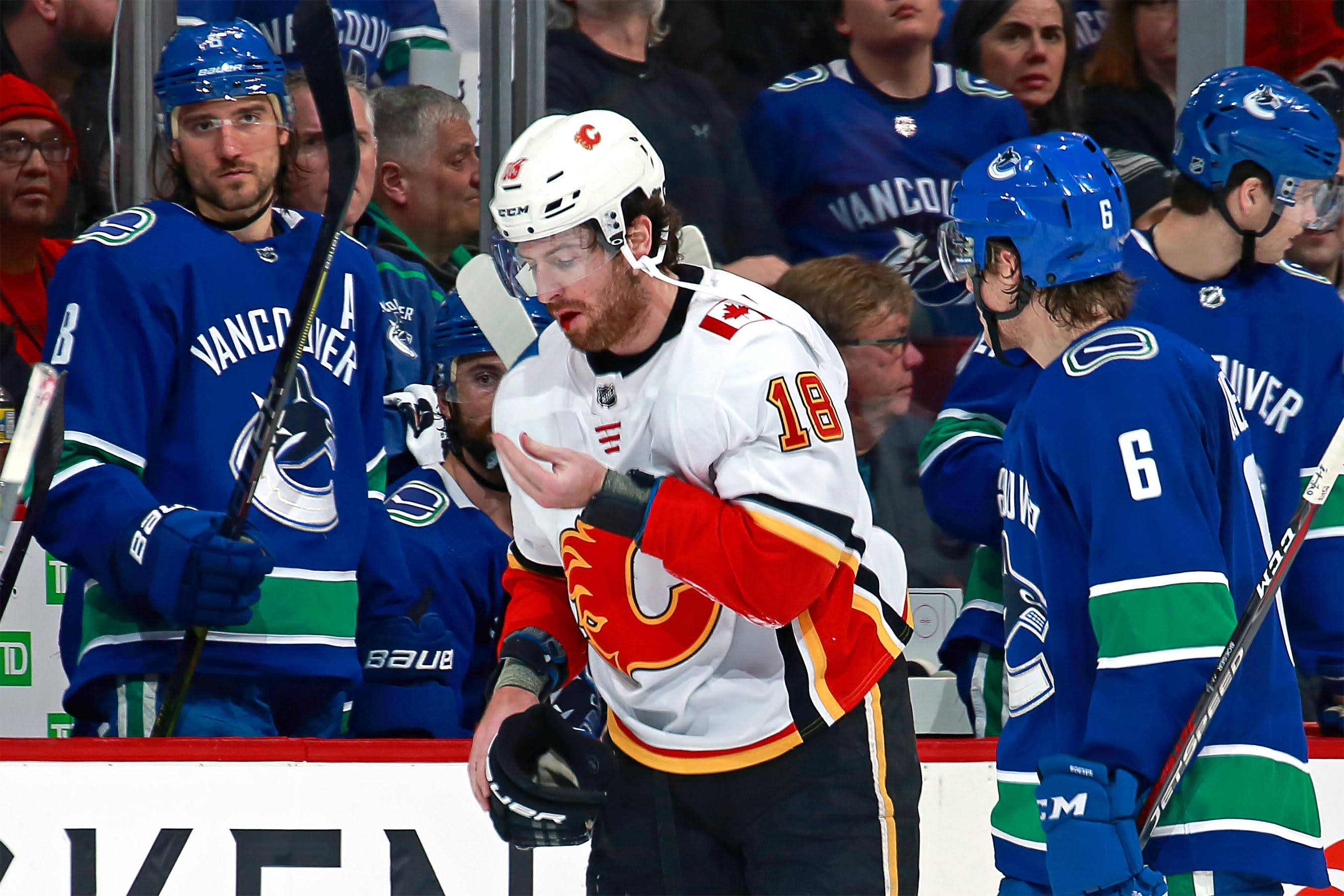 nhl player pulls out tooth