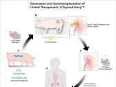 United Therapeutics Announces World’s First Successful Xenothymokidney Transplant