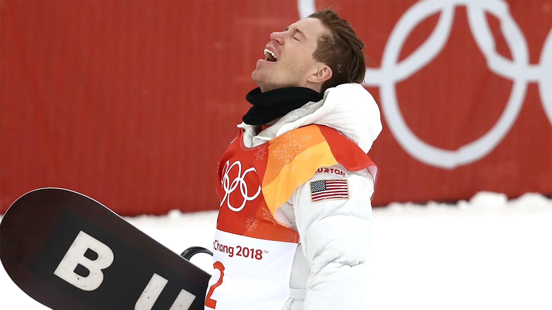 Shaun White -- Ginger Shame?