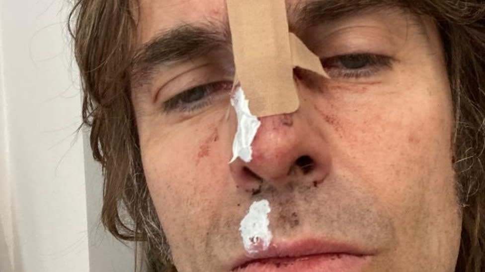 La foto que compartió Liam Gallagher, exlíder de Oasis, tras 'caerse de un helicóptero'