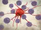 ALX Oncology (ALXO) Posts Upbeat Results From Lymphoma Study