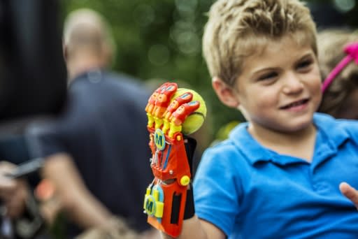 Franzosischer Junge Bekommt Hand Prothese Aus 3d Drucker