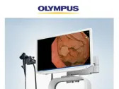 Olympus Announces Market Launch of EVIS X1™ Endoscopy System