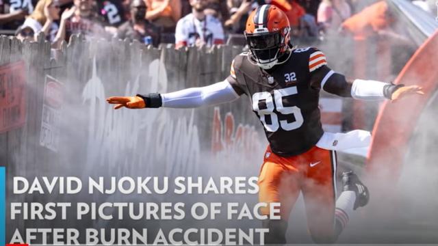 David Njoku Arrives in Mask at Browns Game After Burning Face