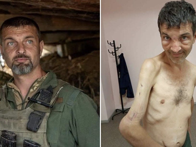 Appeal raises $135,000 for a released Ukrainian POW to help with medical expense..