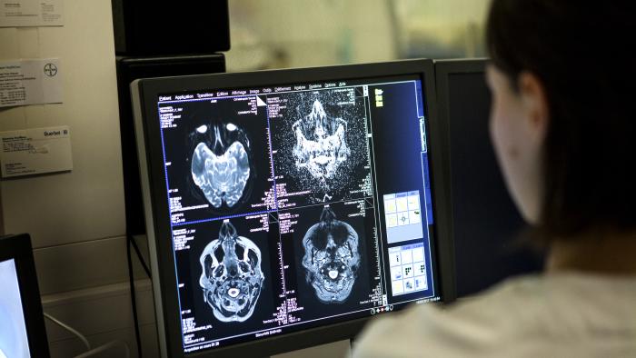 Medical imaging service in a hospital in Savoie, France. A technician monitors a brain MRI scan session. (Photo by: BSIP/Universal Images Group via Getty Images)