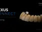 Keystone Dental Announces Market Launch of Nexus Connect, the First A.I. Enabled Intraoral Implant-Scan Analyzer for the Nexus iOS Full-Arch Solution