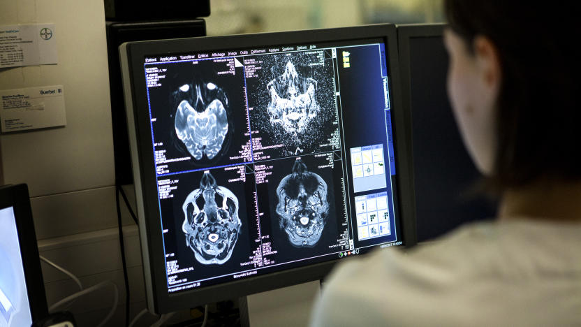 Medical imaging service in a hospital in Savoie, France. A technician monitors a brain MRI scan session. (Photo by: BSIP/Universal Images Group via Getty Images)