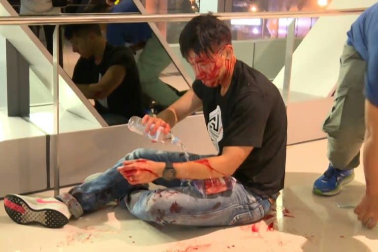 A pro-government mob attacked protesters in Hong Kong on Sunday night (AFP Photo/Handout)