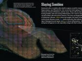 National Geographic Magazine Showcases NanoString’s Spatial Biology Technology to Examine Cell Death in Alzheimer’s Disease