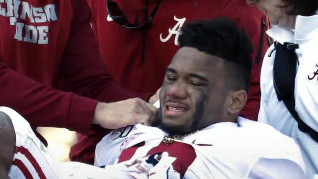 Alabama star Tua Tagovailoa expected to make a ‘Full recovery’