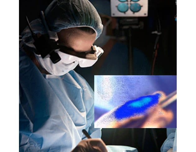 Researchers develop smartglasses that help surgeons see cancerous cells