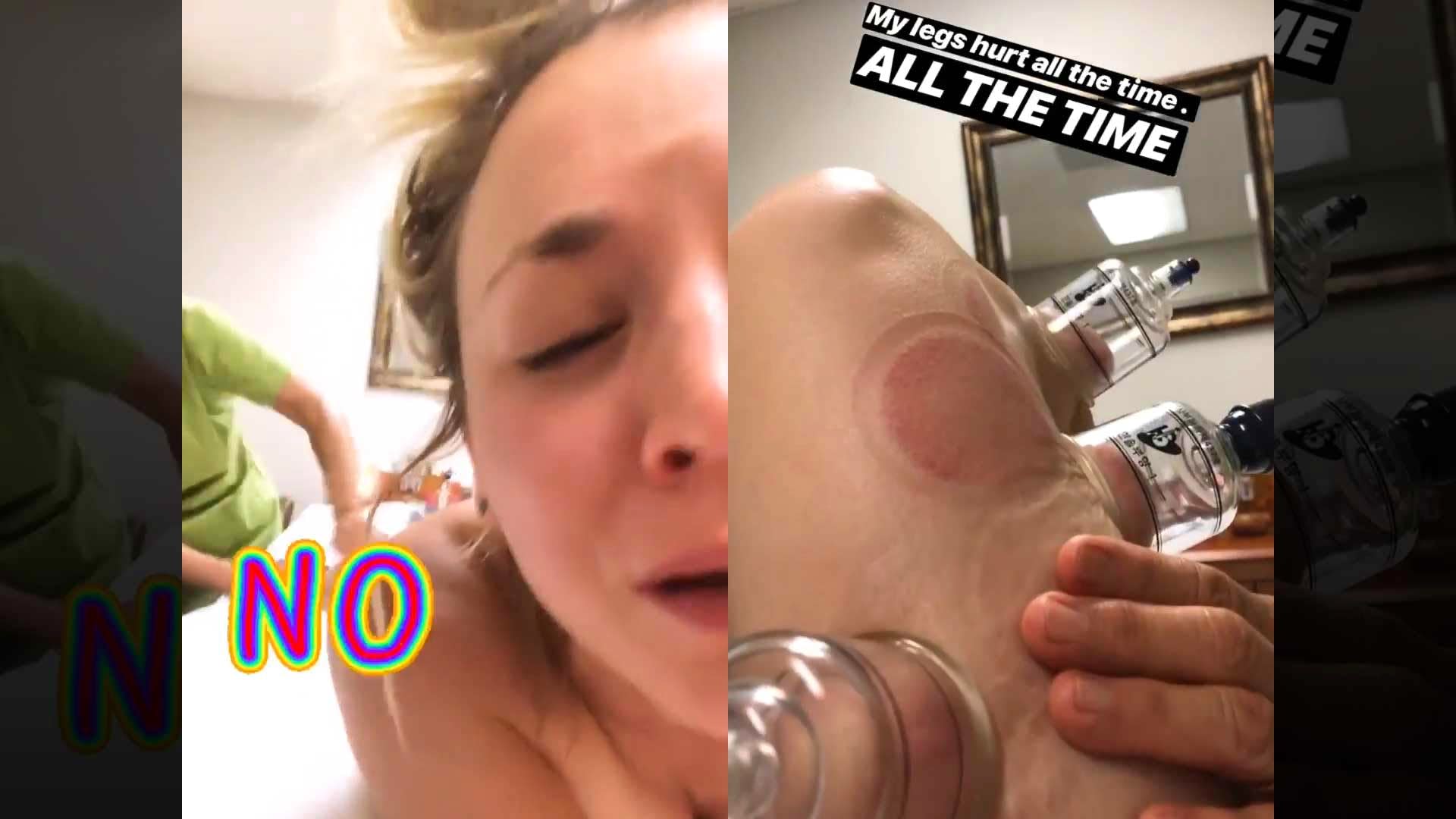 Kaley Cuoco Porn Captions - Kaley Cuoco Shares Painful Cupping Video, Says She Hasn't 'Been Able to  Move in Weeks'