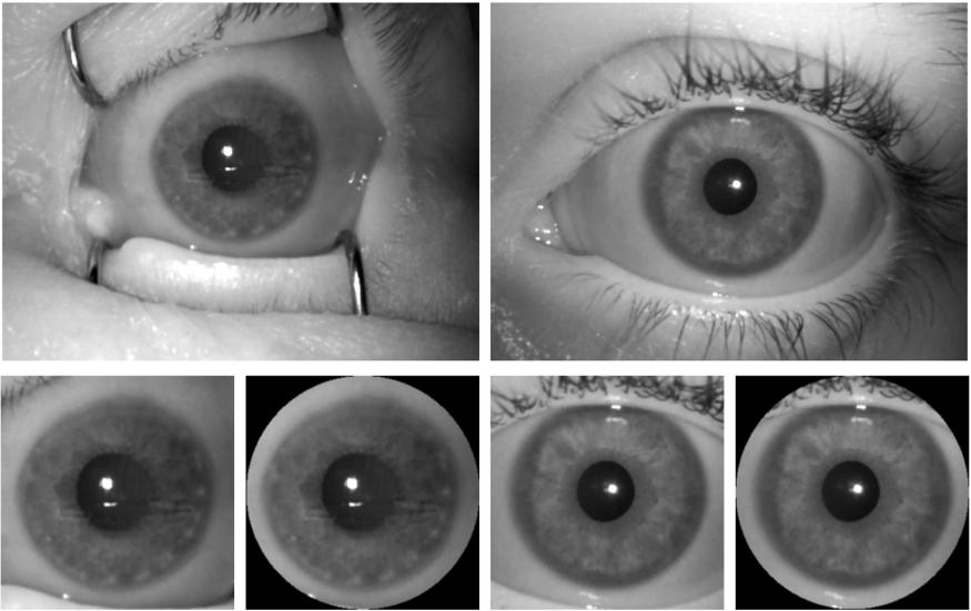 Iris Scanner Ai Can Tell The Difference Between The Living And The Dead