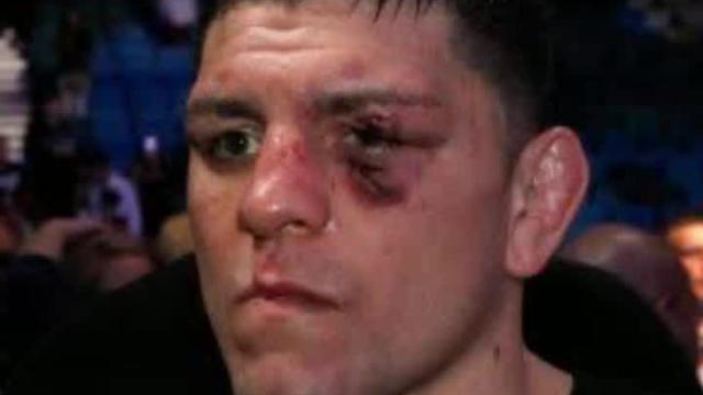 Domestic violence charges against Nick Diaz dropped
