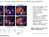 MDNA: Commences Monotherapy Dose Expansion in Phase 1/2 ABILITY Trial…