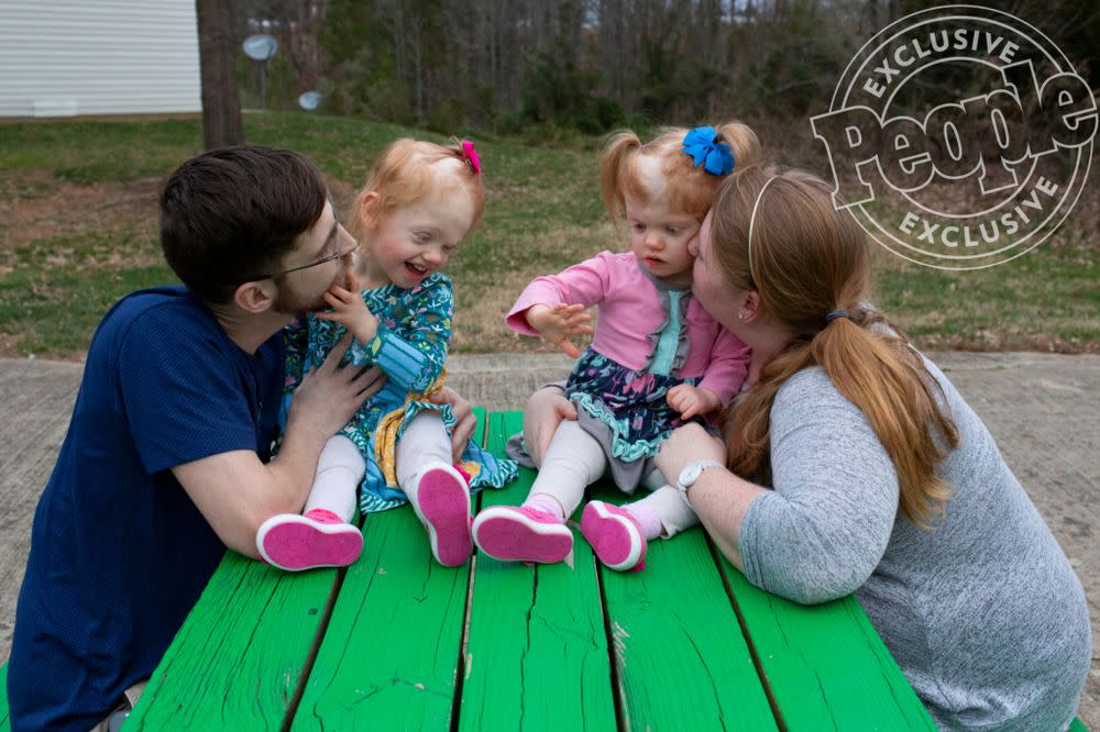 Conjoined Twins Thrive After Surgery Separates Them At The Head They Re Our Little Miracles