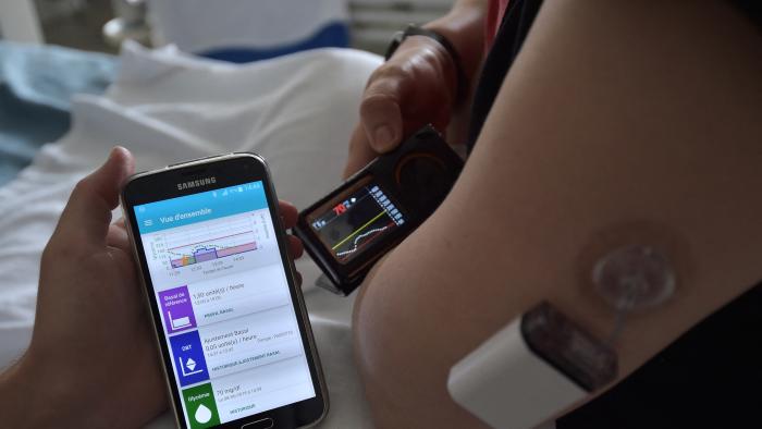 TO GO WITH AFP STORY BY ARNAUD BOUVIER
A diabetic patient holds a smartphone with an application which automatically calculates the good mix to match the needs of insulin, at the central hospital in Strasbourg, eastern France, on June 8, 2016.. An innovation that could change the lives of people with diabetes: an 'artificial pancreas', which injects the right amount of insulin and whose amount is calculated by a smartphone using a complex algorithm, is currently tested on forty-five patients in nine hospitals in France. (Photo by PATRICK HERTZOG / AFP) (Photo by PATRICK HERTZOG/AFP via Getty Images)