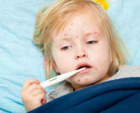 does measles vaccine cause autism
