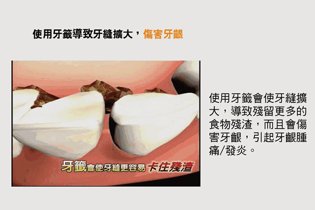 家適帝 專業級強力攜帶型沖牙器