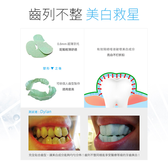 Protis普麗斯 新3D牙托式深層長效組 5-7天