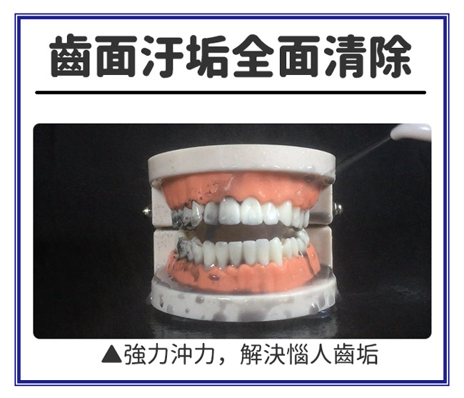 家適帝 旗艦款 牙齒保健全銅高壓沖牙機 (贈壁掛噴頭收納盒)