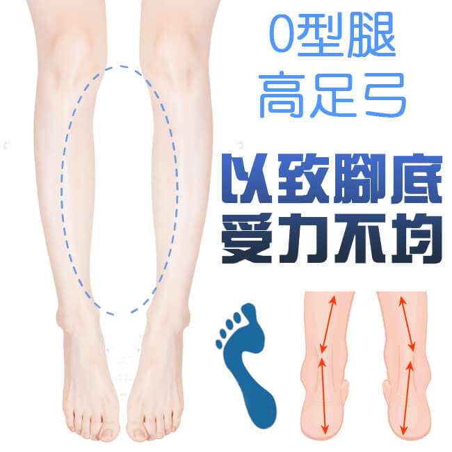 足的美形 O型腿輔助七分墊(2雙)