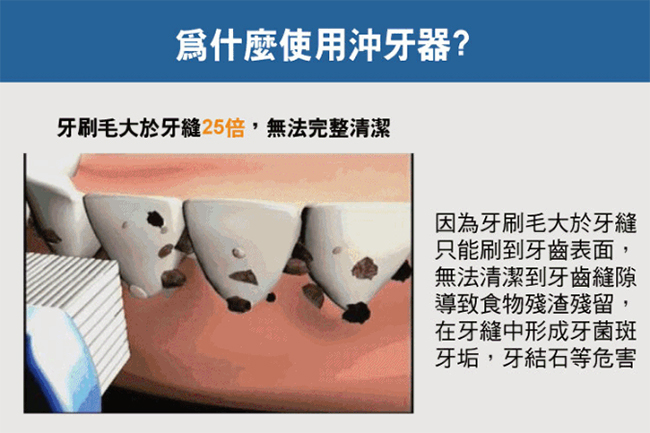 家適帝 超二代專業級氣壓式外出攜帶型強力沖牙器