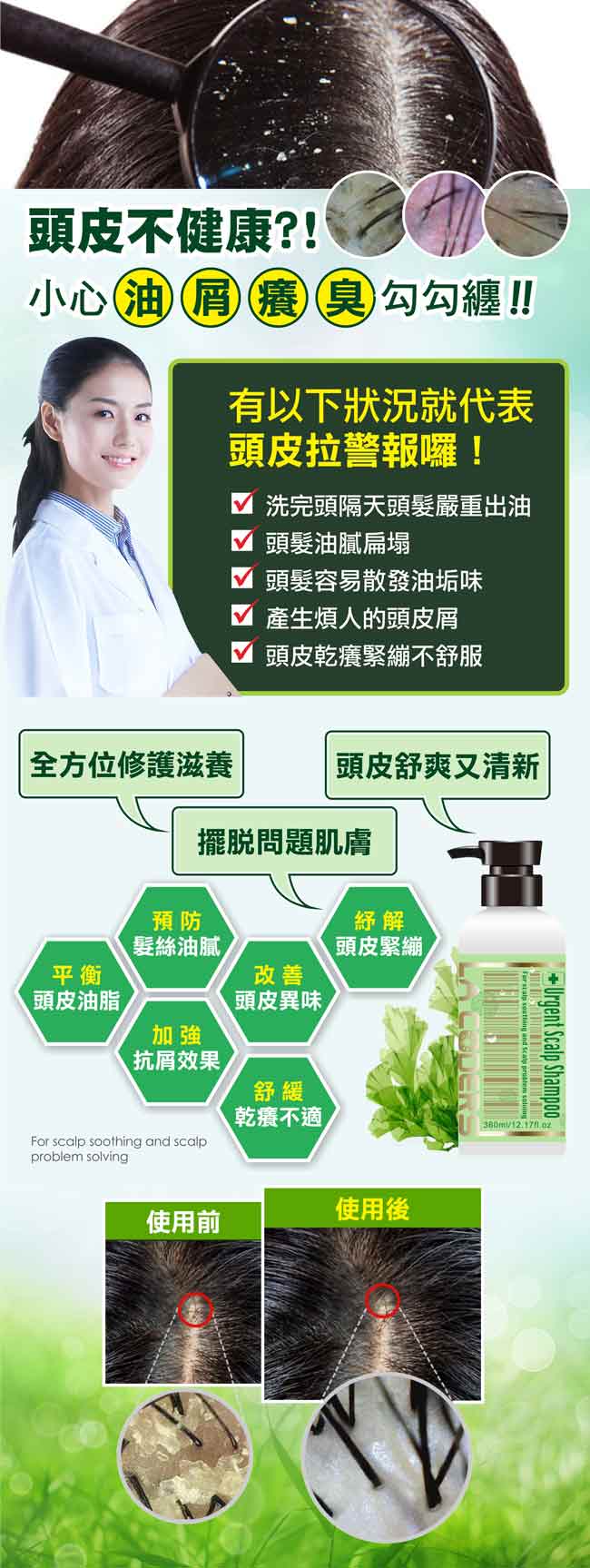 LA CODERS珂妍 119螺旋藻頭皮救急洗髮露360ml