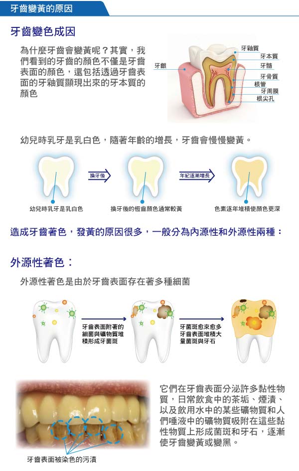 韓國2080 專業亮白牙膏-除垢脫漬(125gX3入)