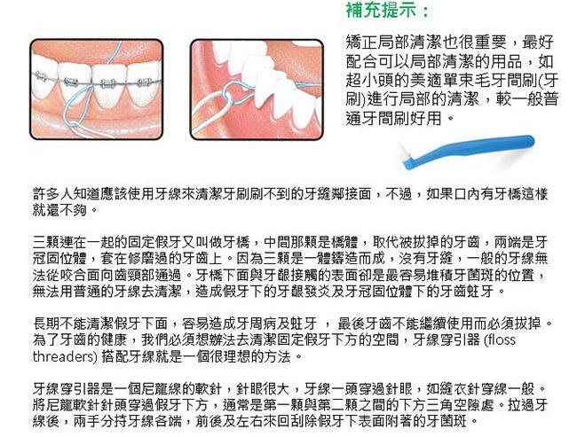 加拿大美適Maxill 牙橋穿引線大圈軟線(5入X4包)